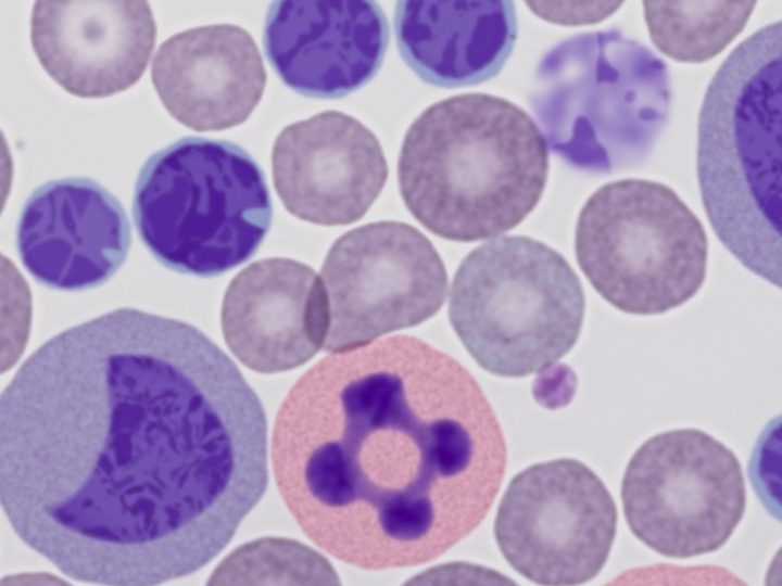 Synthetic blood smear under one set of imaging conditions